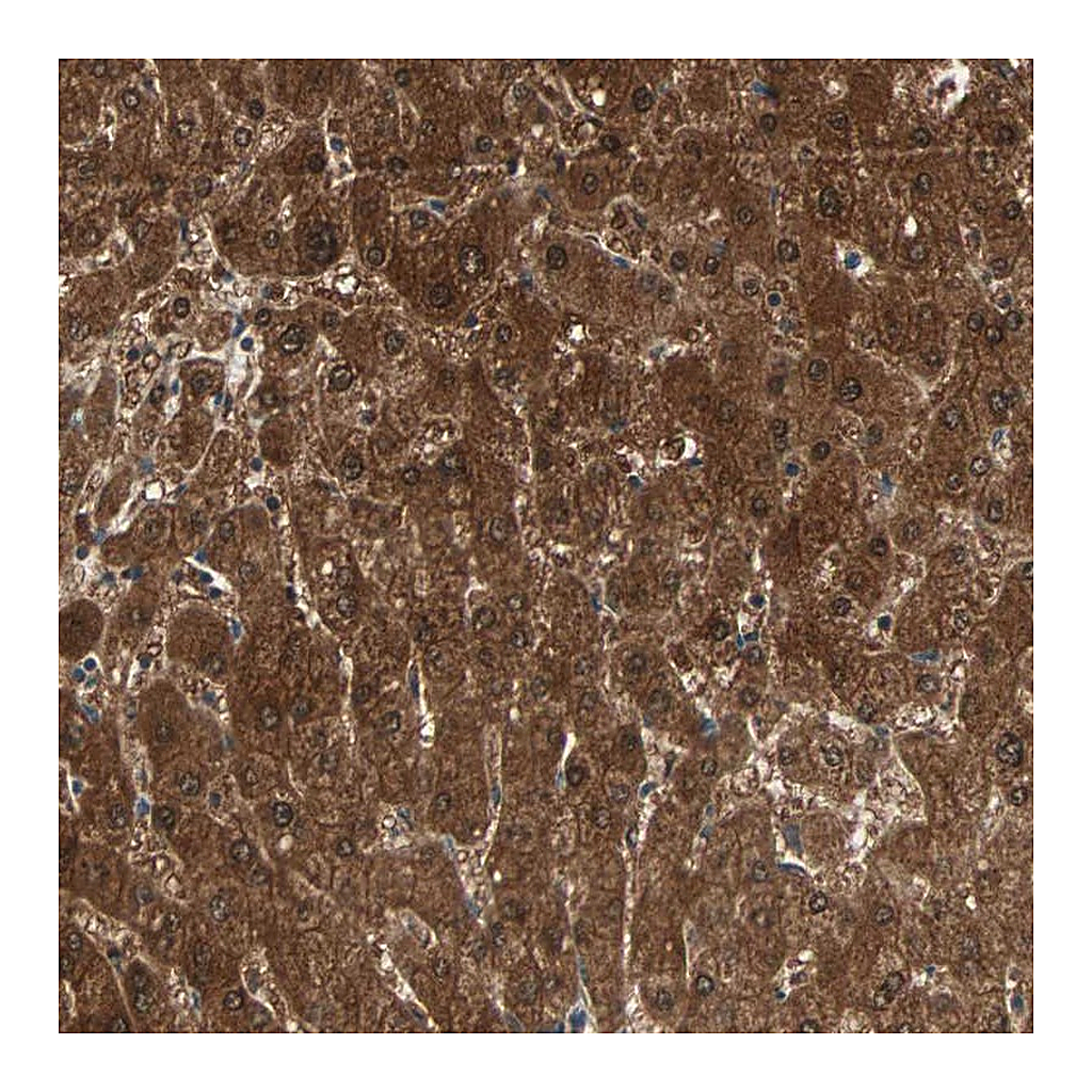Atlas Antibodies Anti-ZSCAN31 Antibody