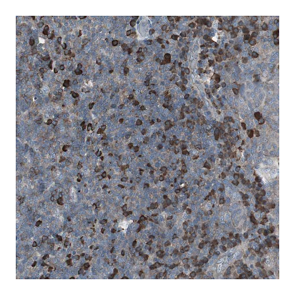 Atlas Antibodies Anti-ZSCAN32 Antibody