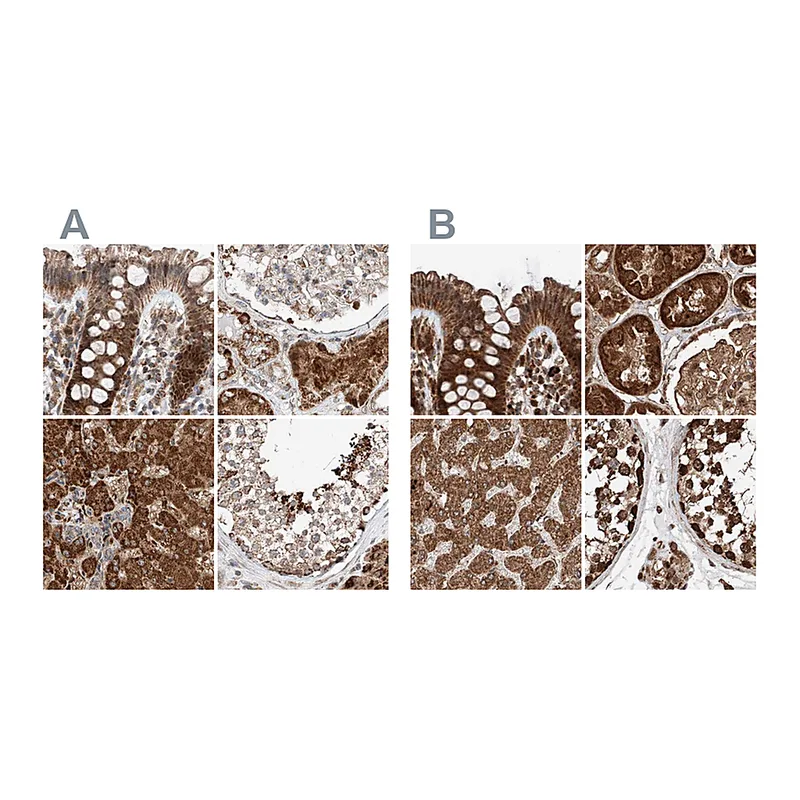 Atlas Antibodies Anti-ZSCAN29 Antibody