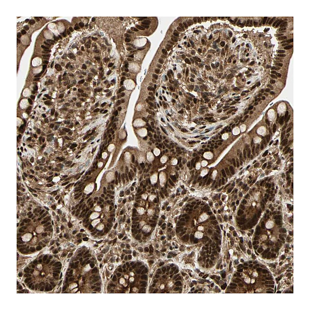 Atlas Antibodies Anti-ZSCAN30 Antibody
