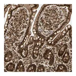 Atlas Antibodies Anti-ZSCAN30 Antibody
