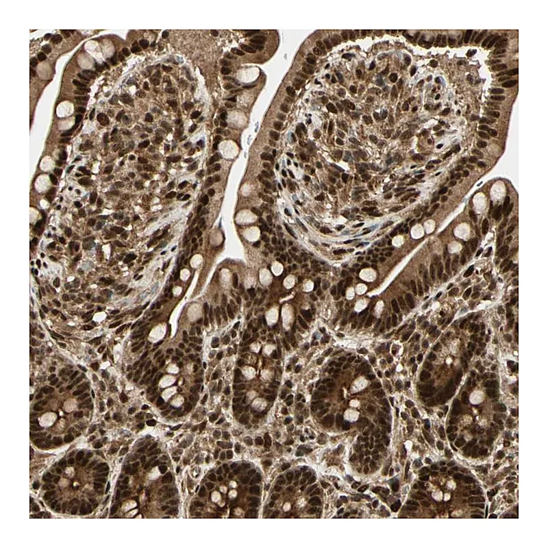Atlas Antibodies Anti-ZSCAN30 Antibody