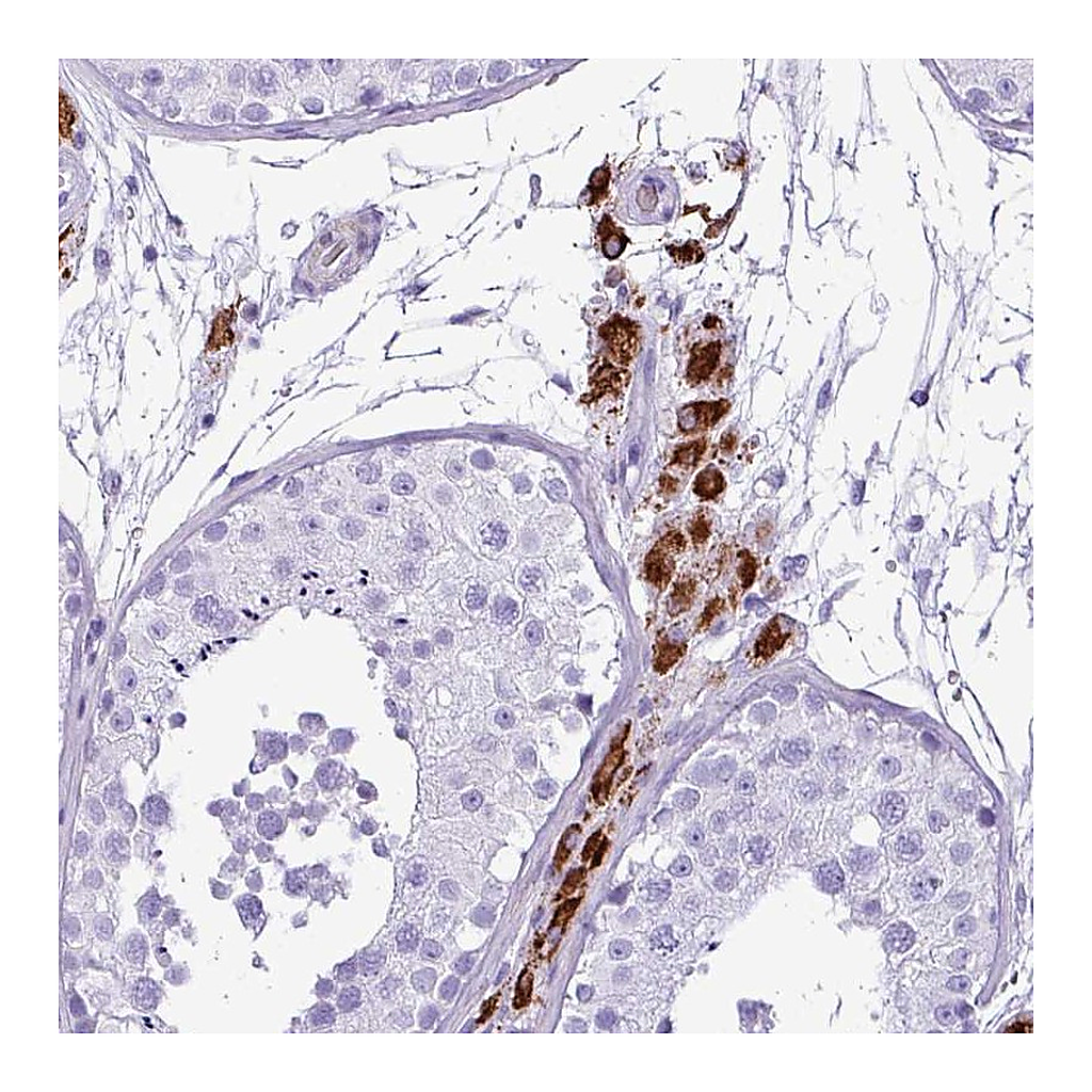 Atlas Antibodies Anti-ZSCAN5A Antibody