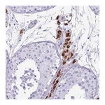Atlas Antibodies Anti-ZSCAN5A Antibody