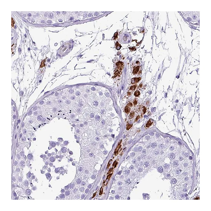 Atlas Antibodies Anti-ZSCAN5A Antibody