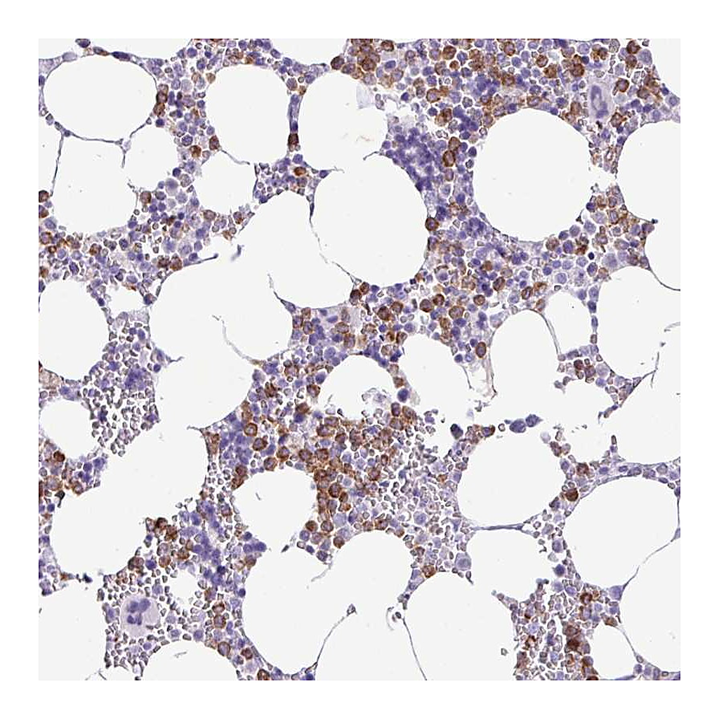 Atlas Antibodies Anti-ZSCAN5A Antibody