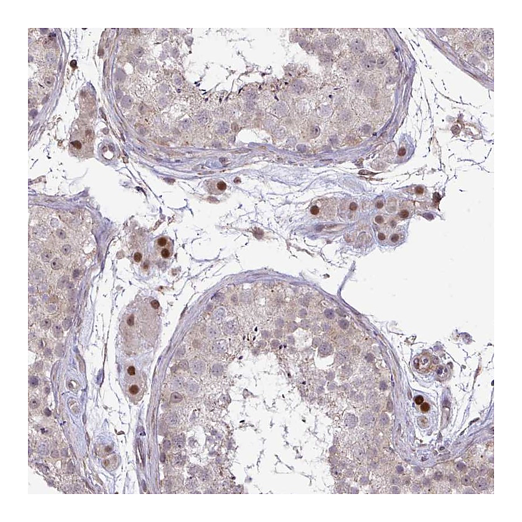 Atlas Antibodies Anti-ZSCAN9 Antibody
