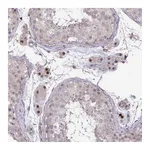 Atlas Antibodies Anti-ZSCAN9 Antibody
