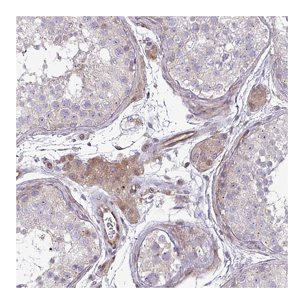 Atlas Antibodies Anti-ZSCAN9 Antibody