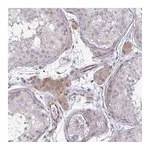 Atlas Antibodies Anti-ZSCAN9 Antibody