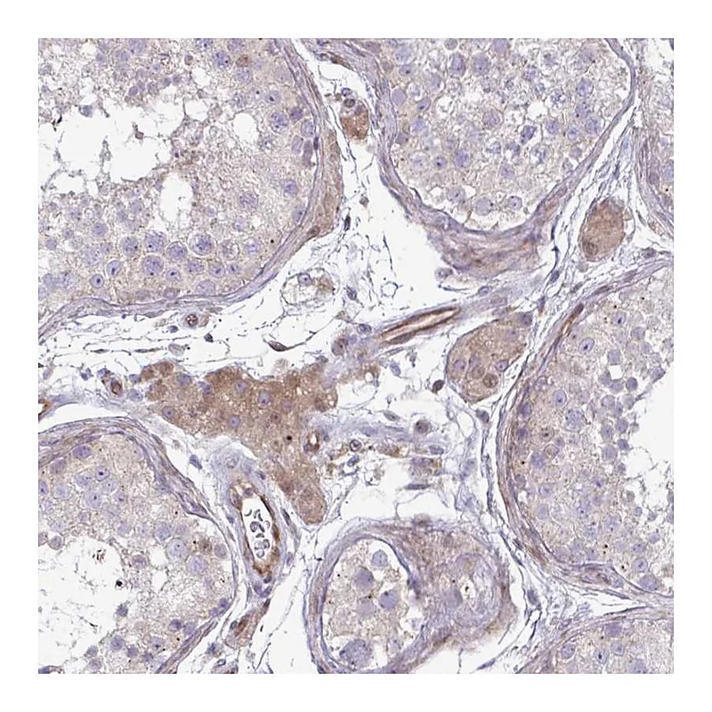 Atlas Antibodies Anti-ZSCAN9 Antibody
