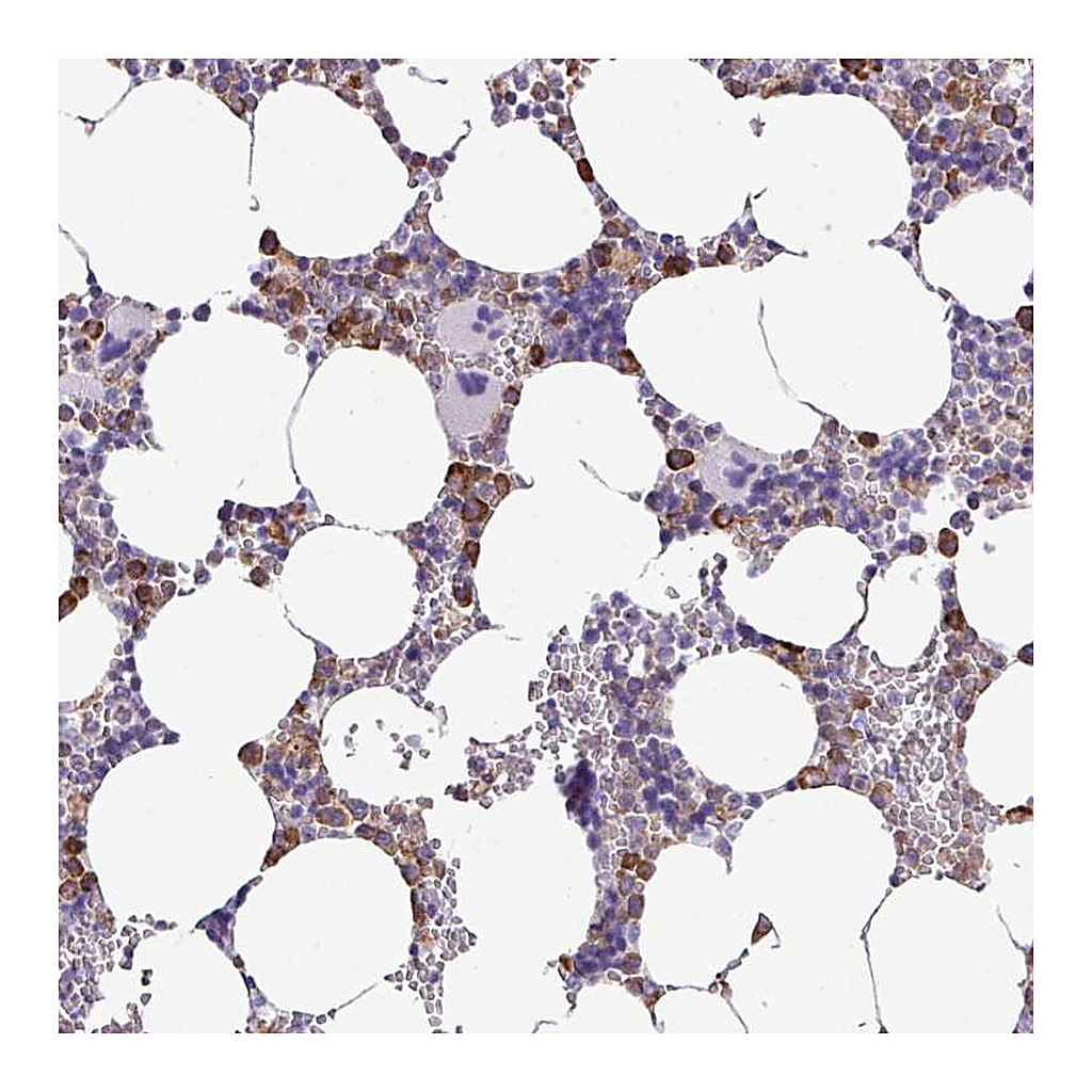 Atlas Antibodies Anti-ZSCAN5A Antibody