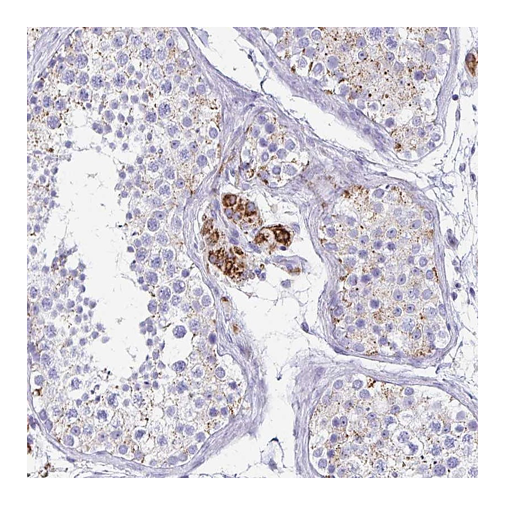 Atlas Antibodies Anti-ZSCAN5B Antibody
