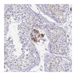 Atlas Antibodies Anti-ZSCAN5B Antibody