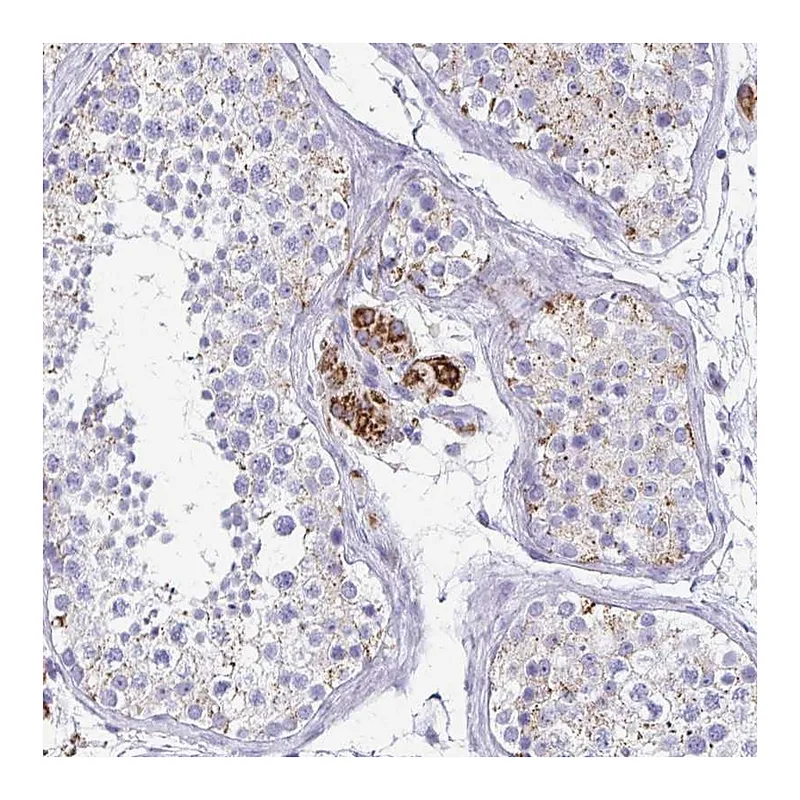 Atlas Antibodies Anti-ZSCAN5B Antibody