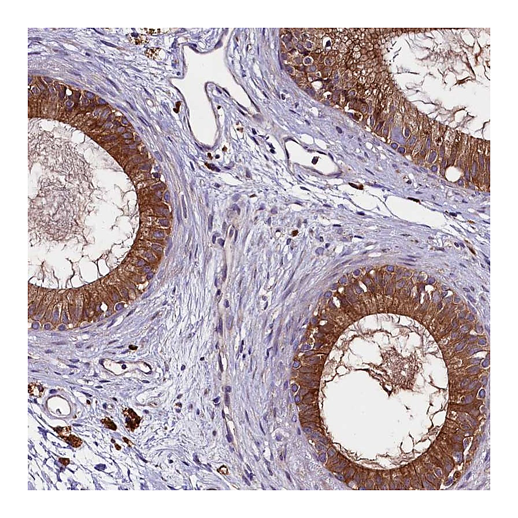Atlas Antibodies Anti-ZSWIM1 Antibody