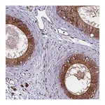 Atlas Antibodies Anti-ZSWIM1 Antibody