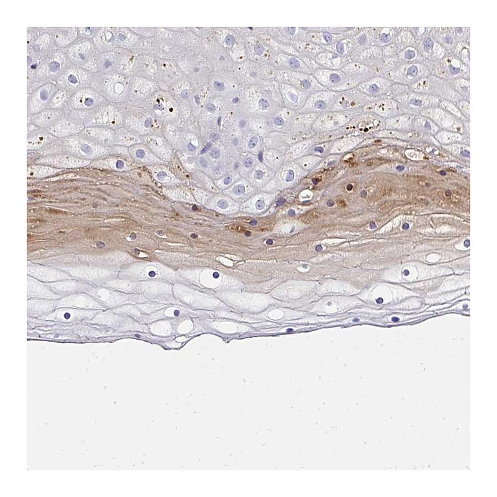 Atlas Antibodies Anti-ZSWIM3 Antibody