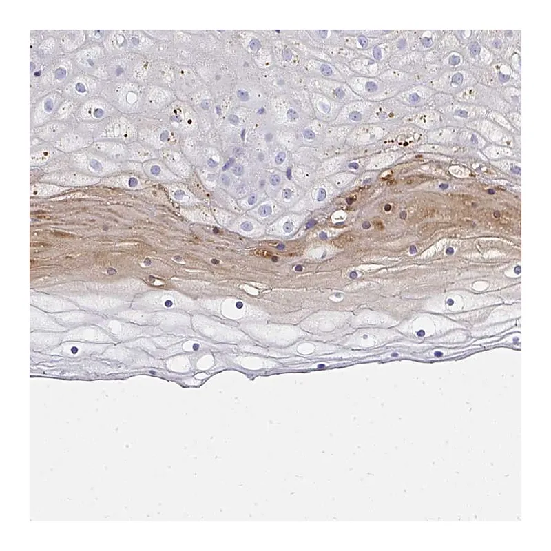 Atlas Antibodies Anti-ZSWIM3 Antibody