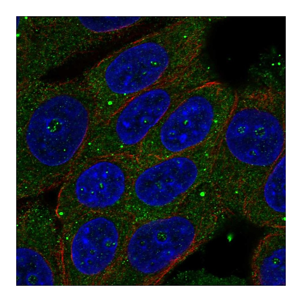 Atlas Antibodies Anti-ZSWIM3 Antibody