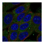 Atlas Antibodies Anti-ZSWIM3 Antibody