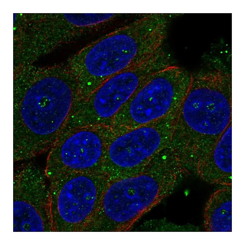 Atlas Antibodies Anti-ZSWIM3 Antibody