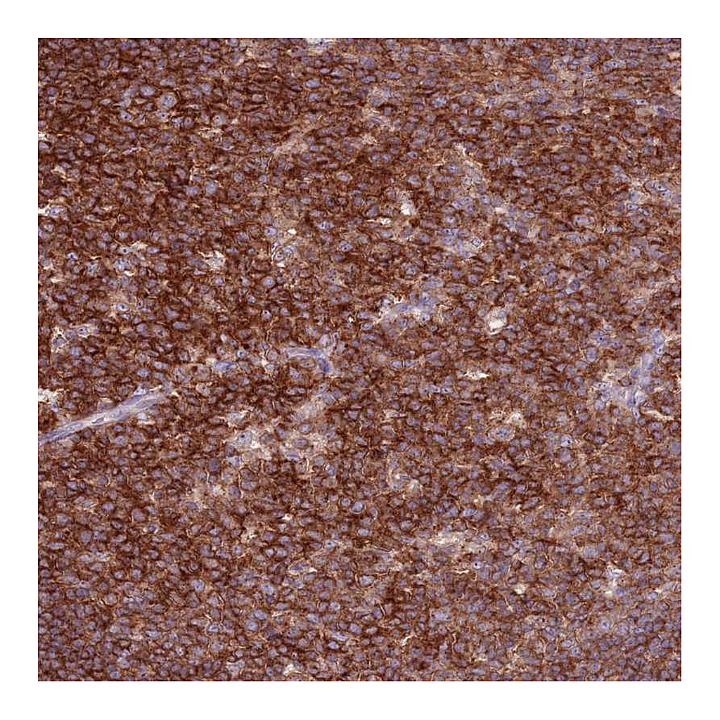 Atlas Antibodies Anti-ZSWIM1 Antibody