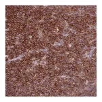 Atlas Antibodies Anti-ZSWIM1 Antibody