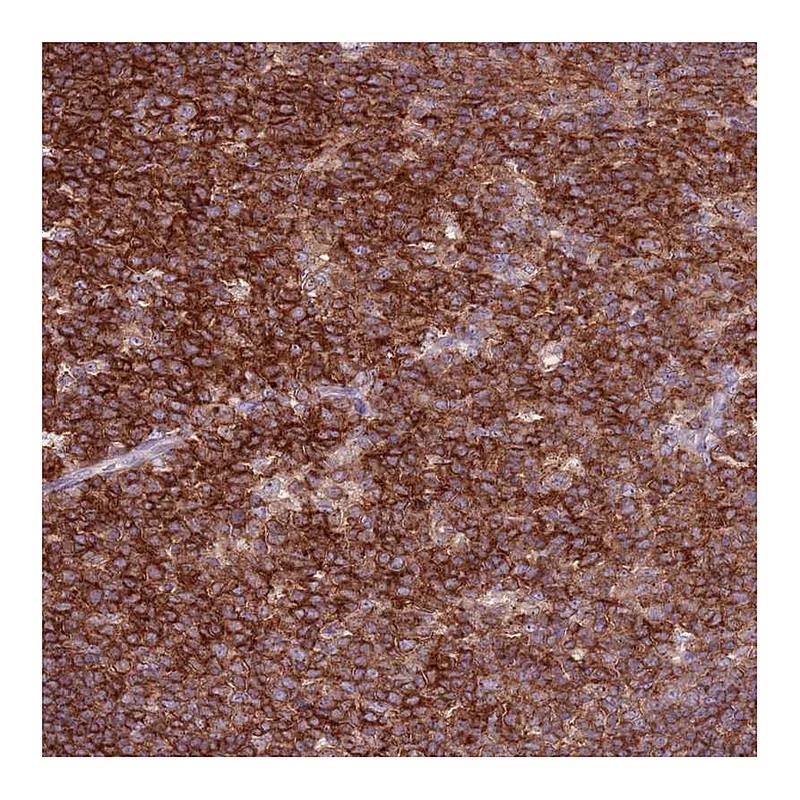 Atlas Antibodies Anti-ZSWIM1 Antibody