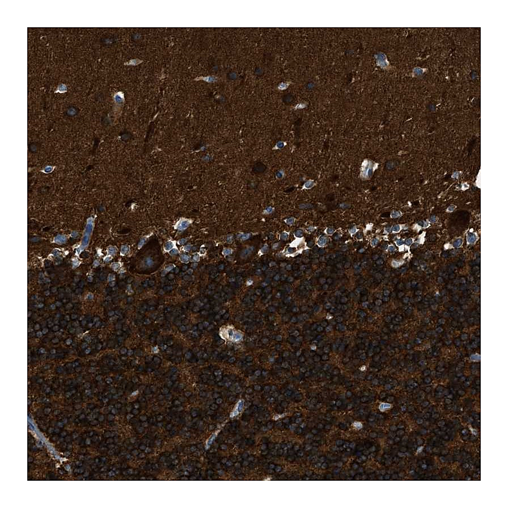 Atlas Antibodies Anti-ZSWIM5 Antibody