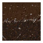 Atlas Antibodies Anti-ZSWIM5 Antibody