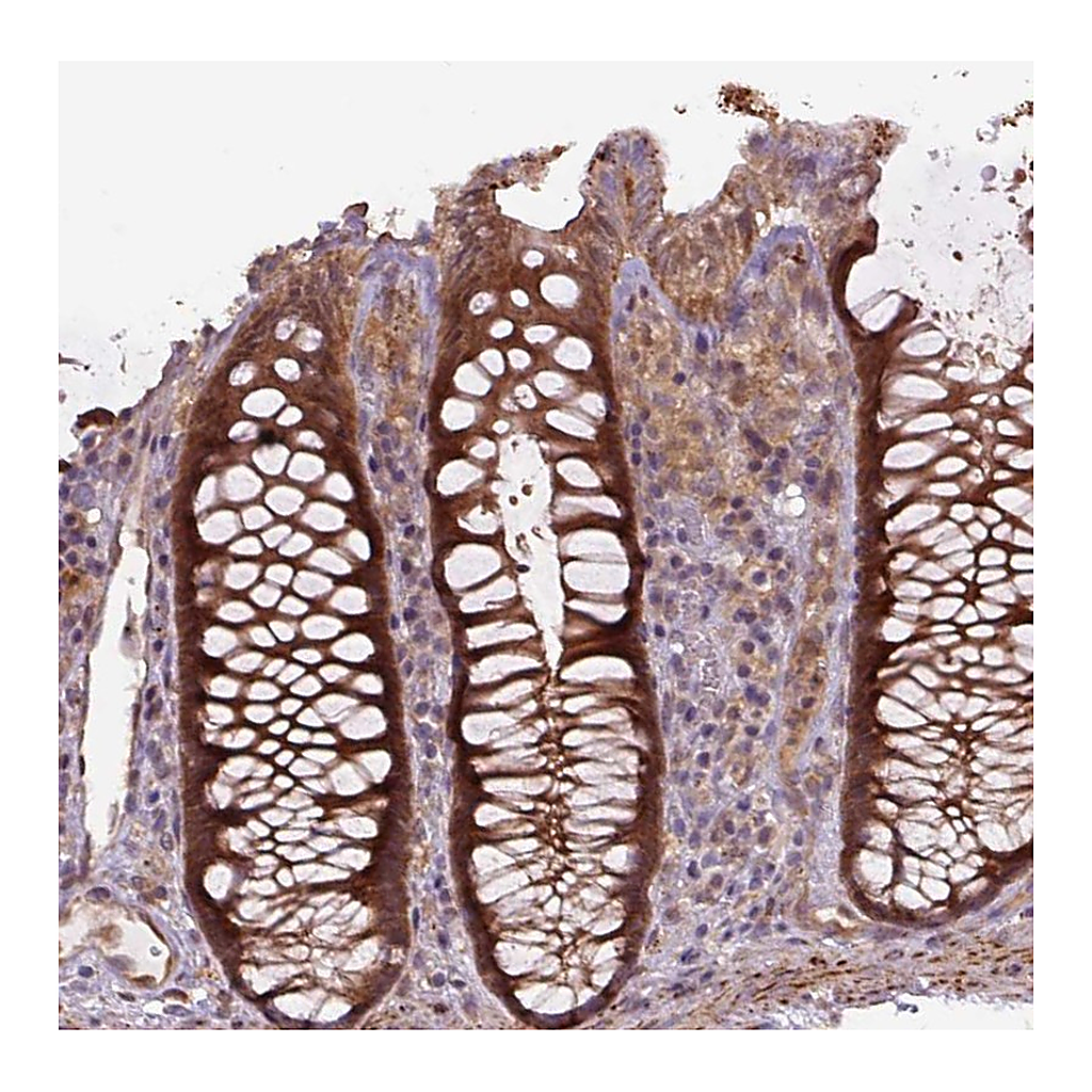 Atlas Antibodies Anti-ZSWIM7 Antibody