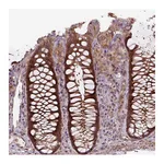 Atlas Antibodies Anti-ZSWIM7 Antibody