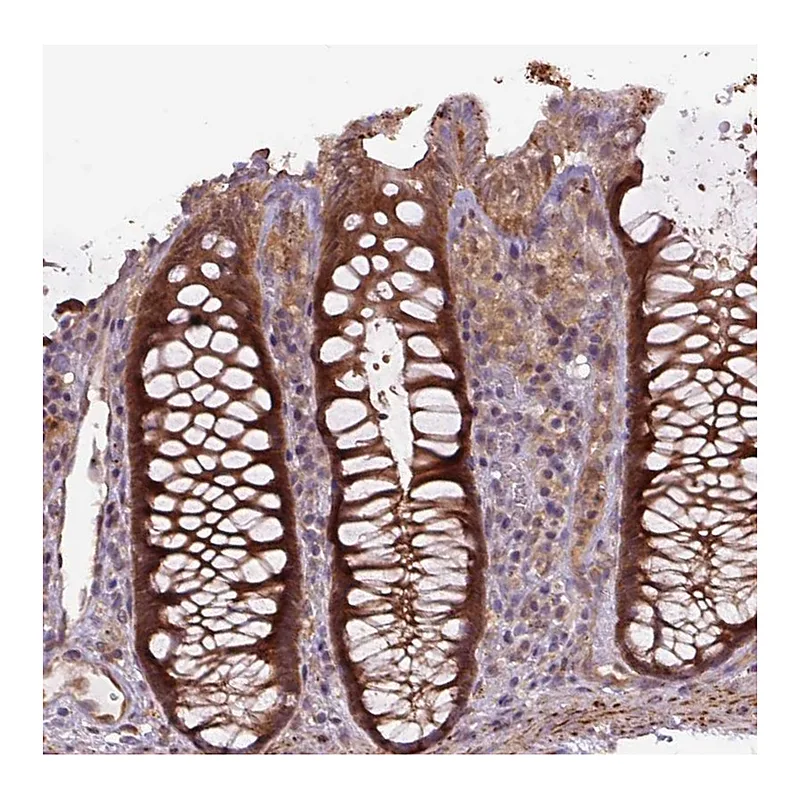Atlas Antibodies Anti-ZSWIM7 Antibody