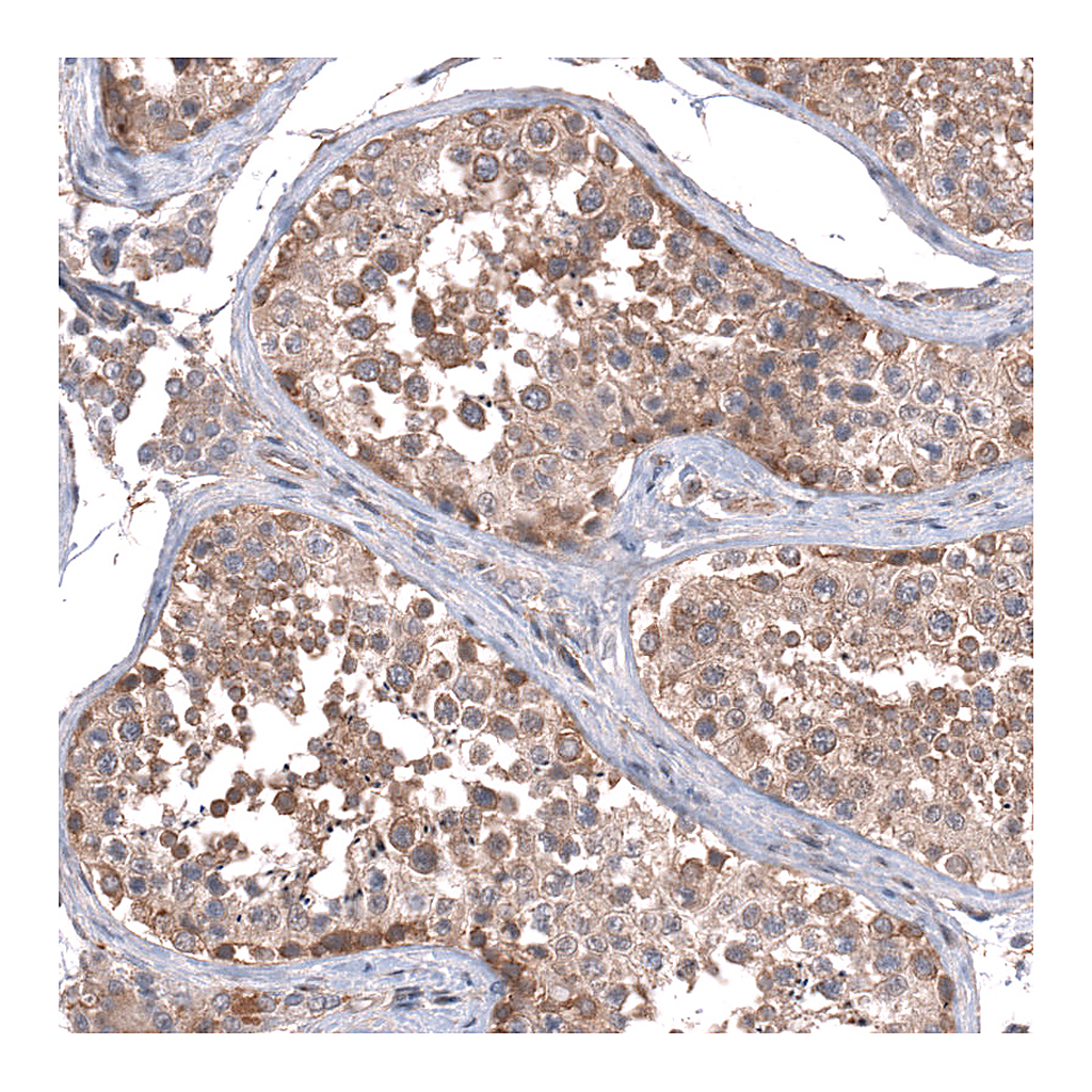 Atlas Antibodies Anti-ZSWIM8 Antibody