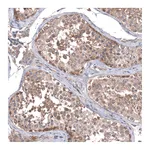 Atlas Antibodies Anti-ZSWIM8 Antibody
