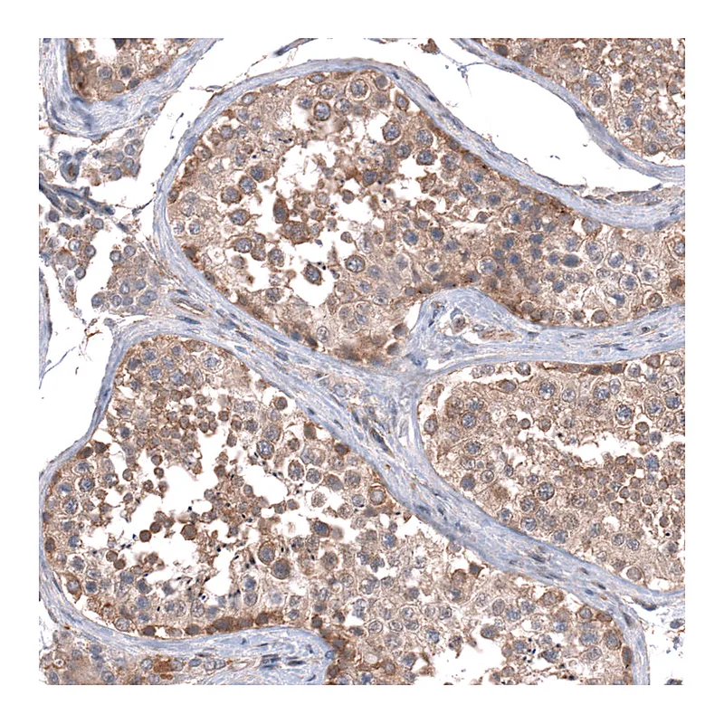 Atlas Antibodies Anti-ZSWIM8 Antibody