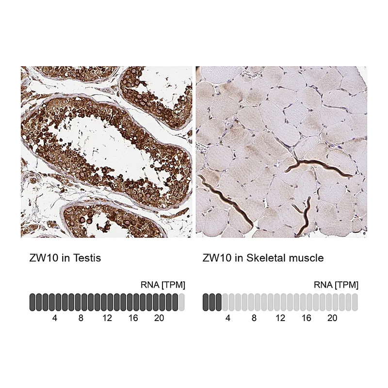 Atlas Antibodies Anti-ZW10 Antibody