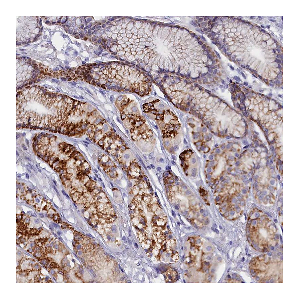 Atlas Antibodies Anti-ZSWIM4 Antibody