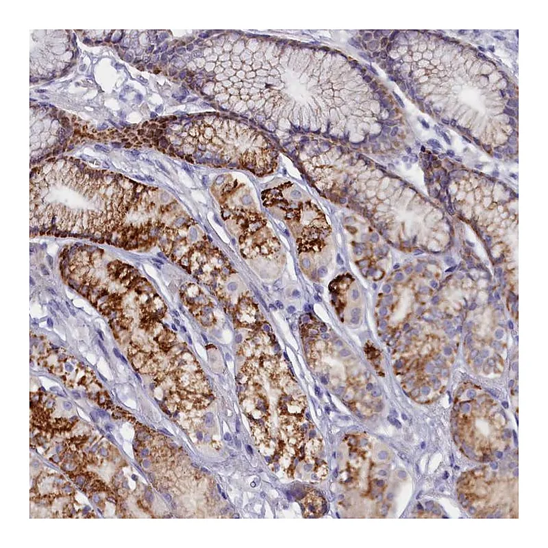 Atlas Antibodies Anti-ZSWIM4 Antibody