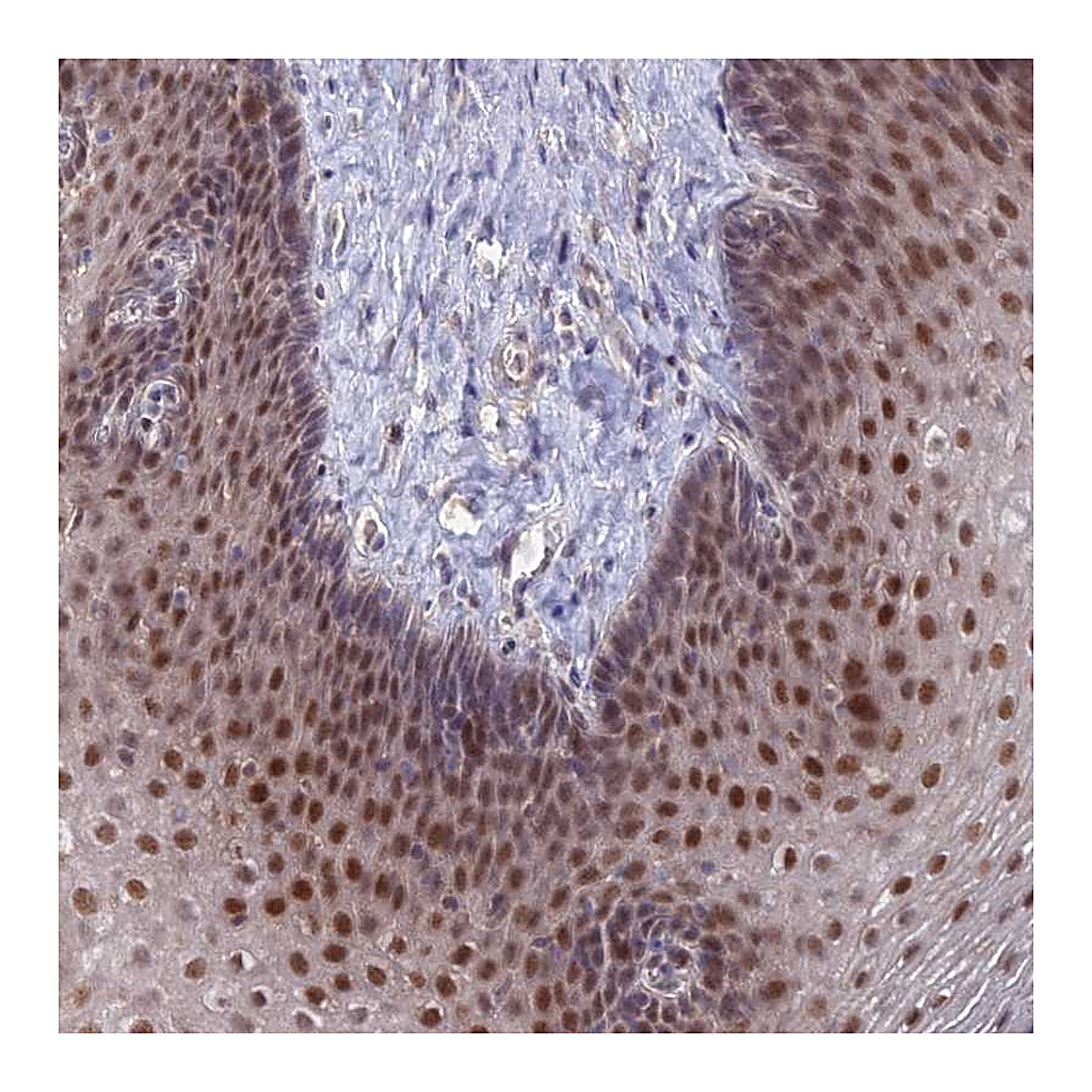 Atlas Antibodies Anti-ZUFSP Antibody