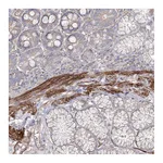 Atlas Antibodies Anti-ZSWIM6 Antibody