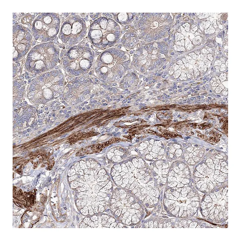 Atlas Antibodies Anti-ZSWIM6 Antibody