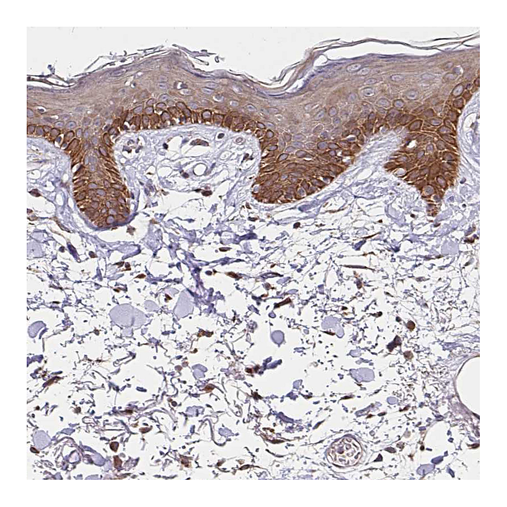 Atlas Antibodies Anti-ZW10 Antibody