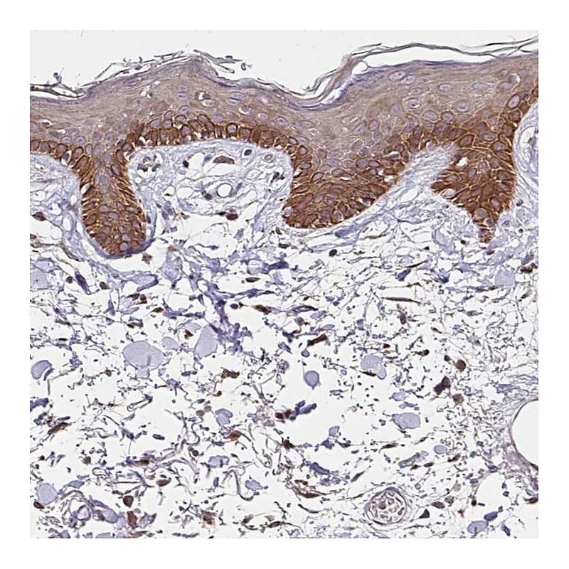Atlas Antibodies Anti-ZW10 Antibody