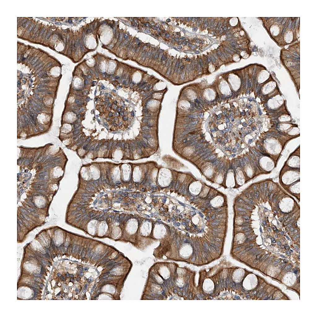 Atlas Antibodies Anti-ZWINT Antibody
