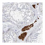 Atlas Antibodies Anti-ZZEF1 Antibody