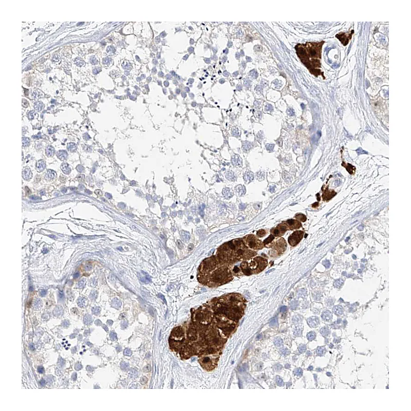 Atlas Antibodies Anti-ZZEF1 Antibody