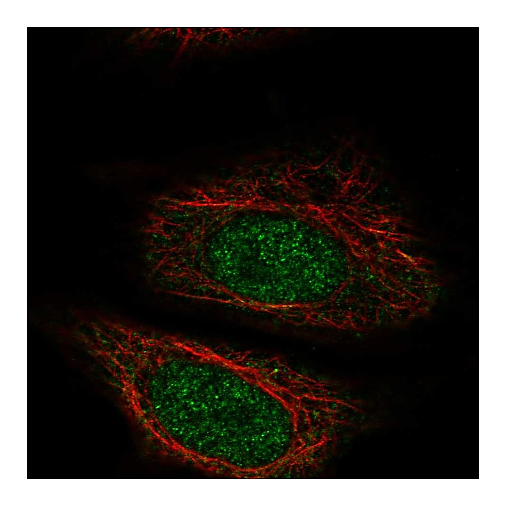 Atlas Antibodies Anti-ZYG11A Antibody