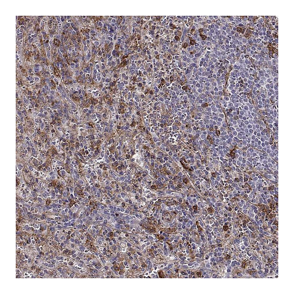 Atlas Antibodies Anti-ZYX Antibody